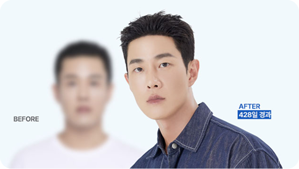 타병원 실패 후 재수술, 이번엔 성공!